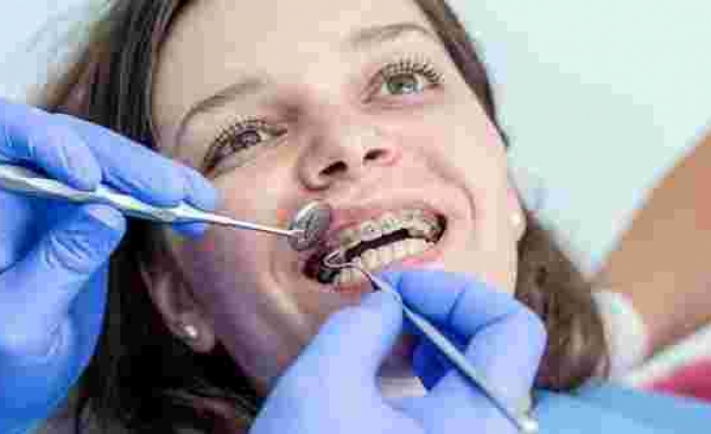 Ortodonti tedavisinde saklı tellerin bakımı herhangi bir probleme yol açar mı?