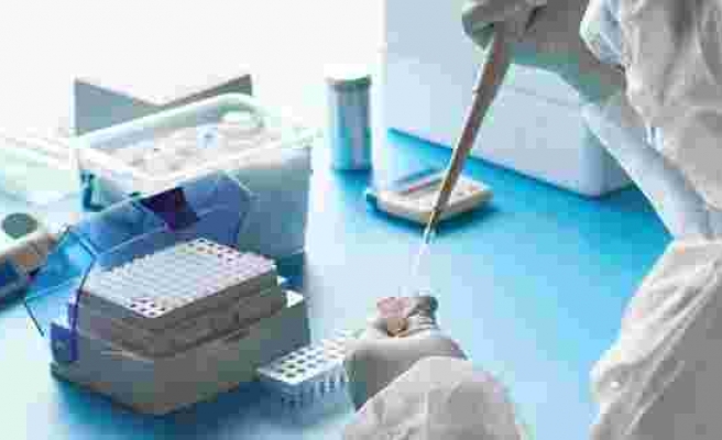 PCR testi yaptırmadan önce nelere dikkat edilmeli?
