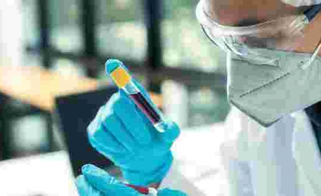 Prof. Dr. Tükek: Covid-19 antikor testlerinin hepsi güvenilir değil