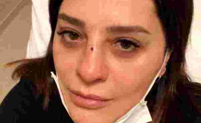 Reyhan Karaca bahçede düşüp, burnunu kırdı