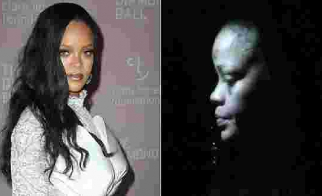 Rihanna’nın yüzündeki morluklar hayranlarını korkuttu
