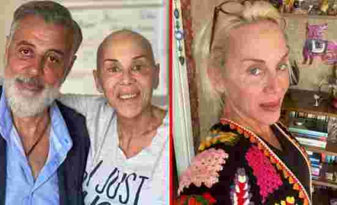 Saçlarını kazıtan Billur Kalkavan'ın akciğer kanserine yakalandığı ortaya çıktı - Haberler
