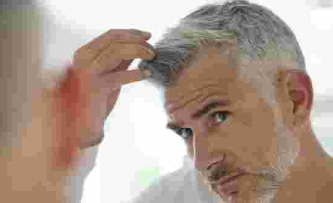 Stresin saçların beyazlamasında etkili olduğu kanıtlandı