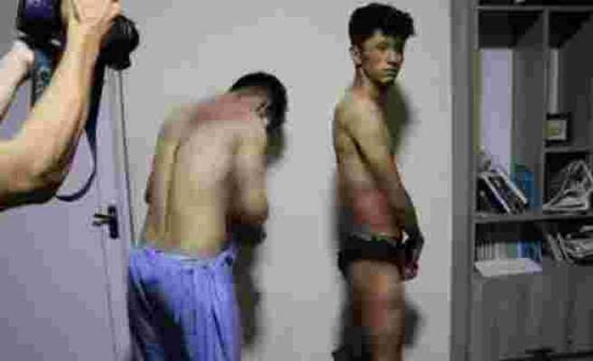 Taliban’dan Afgan gazetecilere 4 saat süren işkence Vücutlarındaki morlukları kameralara gösterdiler