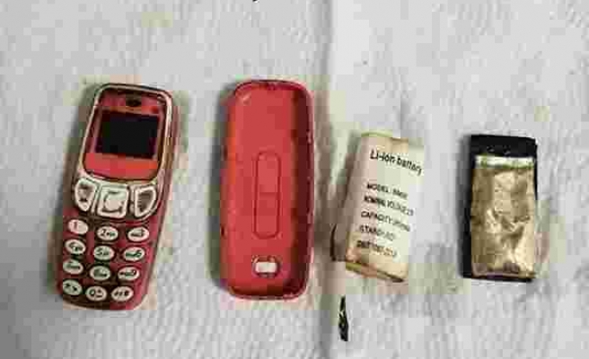 Tam Dört Gün Böyle Yaşamış: Bir Kişinin Midesinden Nokia 3310 Çıktı