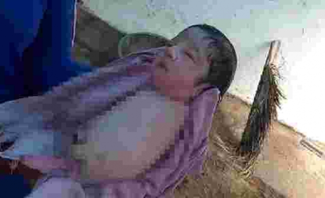 Tıp dünyası Hindistan'da kolsuz ve bacaksız doğan kız bebeğini konuşuyor