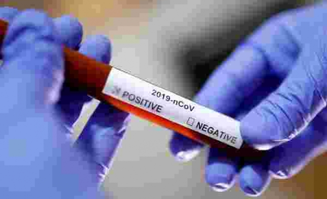 Türkiye'de Bugüne Kadar Kaç Kişiye Koronavirüs Testi Uygulandı?