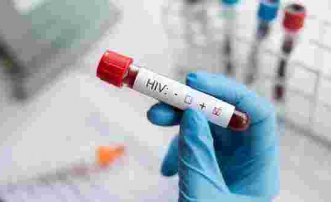 Türkiye’de kaç kişinin HIV virüsü taşıdığı açıklandı