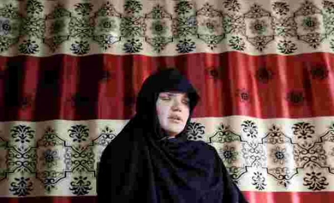 Yıl 2020! Afganistan'da Bir Kadın Çalıştığı İçin Saldırıya Uğradı ve Kör Edildi