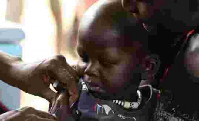 Zimbabve'de 157 çocuk kızamık salgınında hayatını kaybetti